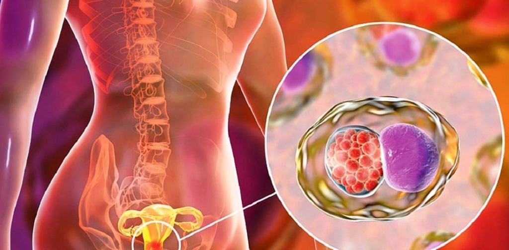 नेपालमा पाठेघरको क्यान्सरले दैनिक चार जनाको मृत्यु